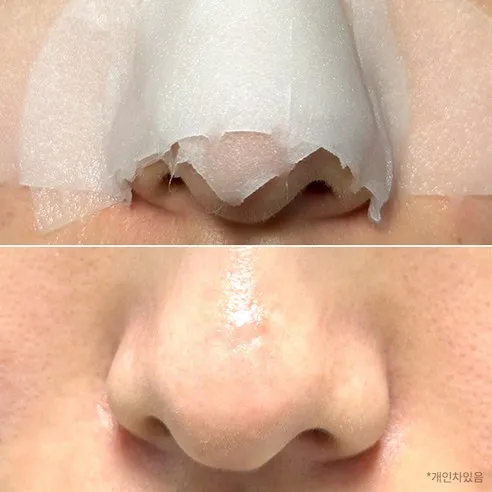 Salicylic™ Pore Trouble Melting Pad - Image 2